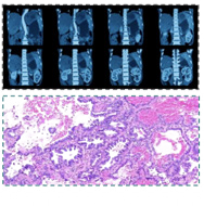 Medical imaging showing a grid of radiological scans of a torso and a microscopic histopathology slide of tissue.