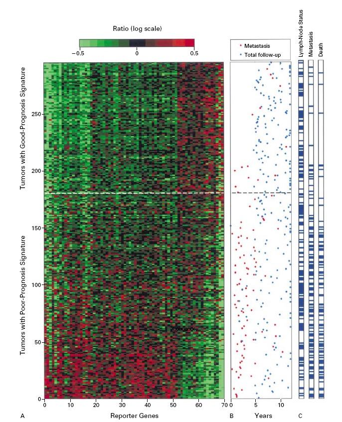 Multi-panel diagram showing gene expression heatmap for good and poor prognosis tumor signatures (A), correlated with patient follow-up and metastasis over years (B), and lymph-node status, metastasis, and death (C).